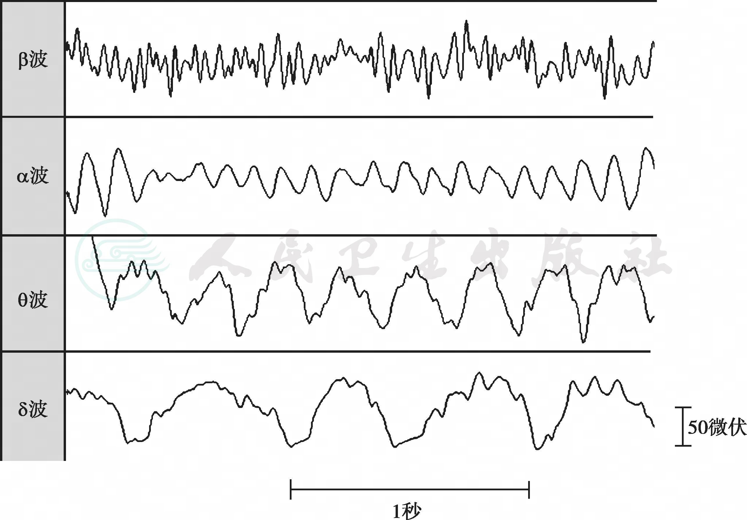 微电生理:资本赋能 竞逐全球电生理市场
