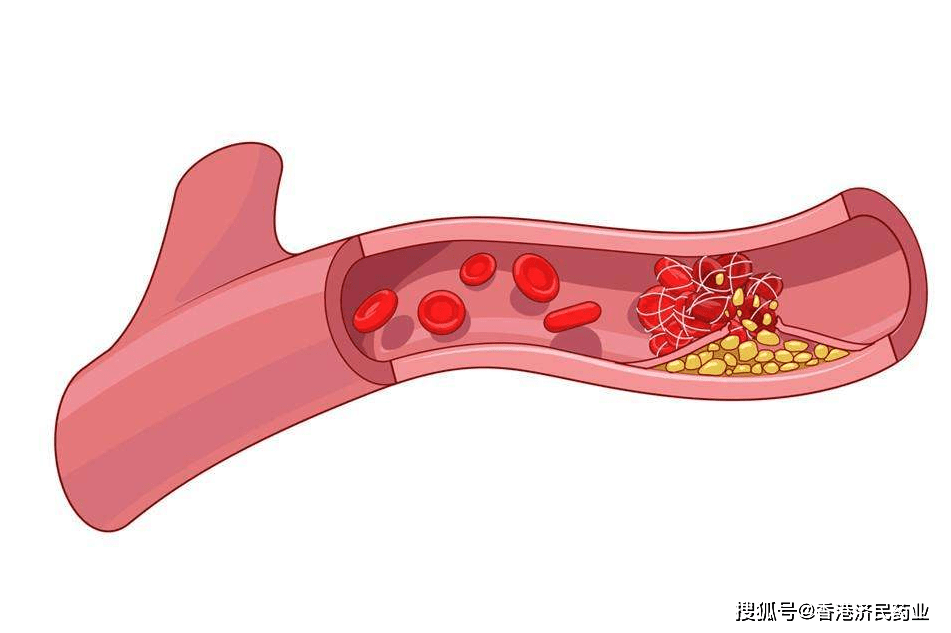 沈南鹏对话TPG、博枫、麦格理：从数据中心到能源变革，另类投资下一站何在？